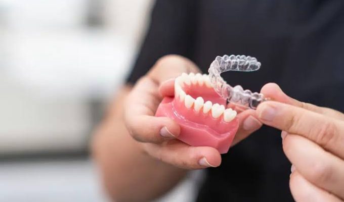 invisalign